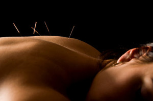 chinese_acupuncture